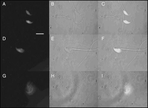 Figure 1.  Morphology of decondensed murine spermatozoa. Decondensation of murine sperm nucleus as visualized with Hoechst stain (A, D, G), under phase contrast (B, E, H), and merged image (C, F, I). Panels A,B,C) unchanged; panels D,E,F) moderately decondensed; panels G,H,I) grossly decondensed. Original magnification: 400x. Scale bar: 10 µm.