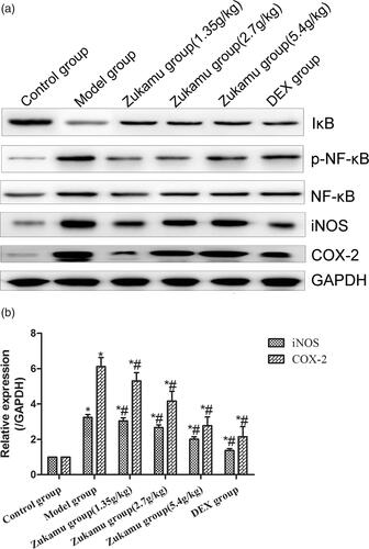 Figure 5. Regulation of NF-κB signalling pathway by zukamu. (a) Expression of proteins related to NF-κB signalling was detected by western blot. (b) mRNA levels of COX-2 and iNOS were evaluated by qRT-PCR. The data represent the mean ± SD, n = 3 per group. *p< 0.05 vs. control, #p< 0.05 vs. Model.