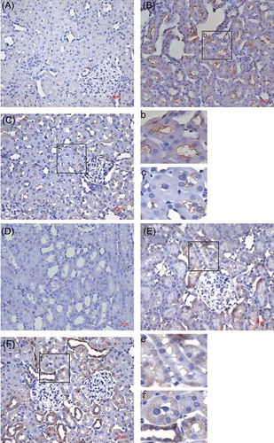 Figure 4. Immunohistochemical staining of Fas in control group (A), I/R + NS group (B), and I/R + NGAL (C); Fas staining was strong on tubular epithelial cell membrane. Bcl-2 in control group (D), I/R + NS group (E), and I/R + NGAL (F); Bcl-2 staining was strong on tubular epithelial cell plasma. Magnification ×100. The magnifications b, c, e, and f were taken from the insert frames.