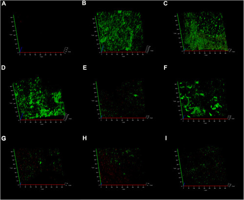 Figure 8 E. faecalis adherence and colonization on the pretreated root canal walls observed by CLSM (green: live cells; red: dead cells).Notes: (A) Blank control group (no background fluorescence produced by dentin); (B) Negative group; (C) CH group; (D) MCSNs group; (E) Ag-MCSNs group; (F) Zn-MCSNs group; (G) Ag/Zn(1:9)-MCSNs group; (H) Ag/Zn(1:1)-MCSNs group; (I) Ag/Zn(9:1)-MCSNs group.Abbreviations: CLSM, confocal laser scanning microscope; CH, calcium hydroxide; MCSNs, mesoporous calcium-silicate nanoparticles; Ag-MCSNs, nanosilver-incorporated MCSNs; Ag/Zn-MCSNs, nanosilver- and nanozinc-incorporated MCSNs; Zn-MCSNs, nanozinc-incorporated MCSNs.
