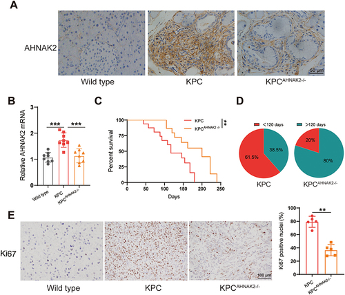 Figure 4 AHNAK2 knockout impairs tumorigenicity and progression in KPC mice. (A) Representative images of AHNAK2 immunohistochemical staining in the pancreas of wild type (WT), KPC and KPCAHNAK2−/− mice (scale bar, 50 µm). (B) qRT-PCR analysis of AHNAK2 mRNA expression in WT, KPC and KPCAHNAK2−/− mice (n=8). (C) Kaplan-Meier survival curves of KPC (n=13) and KPCAHNAK2−/− mice (n=10). (D) Pie charts represent the percentage of animals in each group that survived longer than 120 days (dark green). (E) Representative images of immunohistochemical staining of the proliferation marker Ki67 in the pancreatic tissues of WT, KPC and KPCAHNAK2−/− mice, and quantification of the nuclei positive for this marker (n=5 per genotype). Each bar represents Mean ± SD. **p<0.01; ***p<0.001.