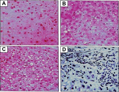 Figure 8 Histologic sectioning for the liver: A) normal liver, B) steatosis fatty liver grade one, C) steatosis fatty liver grade two and D) steatohepatitis grade one. Note: The arrows indicate the presence of adipocytes in each section.