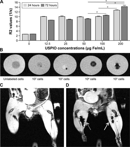 Figure 2 MRI of ASC-USPIO.Notes: (A) R2 values (1/s) of ASCs unlabeled and labeled with increasing USPIO concentrations (12.5 µg Fe/mL, 25 µg Fe/mL, 50 µg Fe/mL, 100 µg Fe/mL, and 200 µg Fe/mL) after 24 hours and 72 hours of incubation. Data expressed as mean ± SD. *P<0.05. R2, relaxivity (1/s) of ASC-USPIO nanoparticles. (B) Representative MR images of gel phantom containing labeled ASCs acquired for the evaluation of the detection limit. Different amounts (from 102 to 105 cells) of ASC-USPIO were used. MRI can efficiently detect up to 102 cells in vitro. In vivo MR images of acquired preintramuscular (C) and postintramuscular (D) injections of 5×103 (dotted arrow) and 2.5×103 (arrow) ASC-USPIO. After intramuscular injection (D), we detected up to 2.5×103 ASC-USPIO.Abbreviations: ASC, adipose stem cell; MR, magnetic resonance; MRI, magnetic resonance imaging; USPIO, ultrasmall superparamagnetic iron oxide nanoparticles.