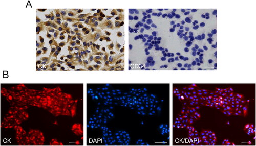 Figure 3. Characterisation of HGECs. (A) Immunocytochemistry results showed that CK was positively expressed in the cytoplasm of HGECs, while CD34 was negatively expressed in the cytoplasm of cells. Scale bar = 50 µm. (B) CK was positively displayed in the cytoplasm of HGECs, showing red fluorescence. Scale bar = 200 µm.