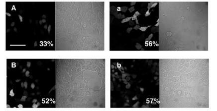 Figure 7 Photomicrographical images of NIH 3T3 cells expressing EGFP under both bright-field and fluorescent microscopy. (A) 24 hours’ transfection with DNA encapsulated in chitosan–alginate core-shell nanoparticles; (a) 24 hours’ transfection with PEI–DNA complexes; (B) 48 hours’ transfection with DNA encapsulated in chitosan–alginate core-shell nanoparticles; (b) 48 hours’ transfection with PEI–DNA complexes. These images represent one set of triplicate experimental data. Scale bar = 20 μm.Abbreviations: EG FP, enhanced green fluorescent protein; PEI, polyethyleneimine.