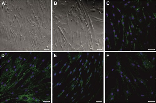 Figure 1 Morphology of expanded hBM-MSCs after 24 hours (A) and 7 days (B) cell culture in vitro. The immunohistochemical analysis of hBM-MSCs positively stained for STEM121 (C), CD44 (D), CD73 (E), and CD90 (F) proteins (green); cell nuclei were labeled with Hoechst (blue). Scale bar =50 μm.Abbreviation: hBM-MSCs, human bone marrow mesenchymal stem cells.