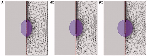 Figure 4. Finite element models and their mesh modes used in the present study for three sizes of target tissues: (A) 25 mm, (B) 30 mm and (C) 35 mm.