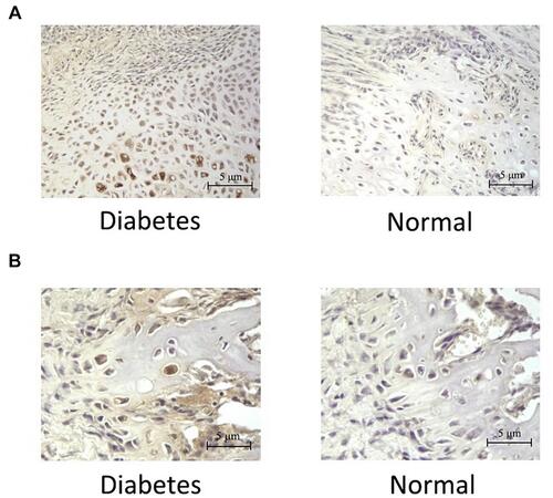 Figure 2 Expression of TNF-α in osteotylus. (A) Immunohistochemical results showing the expression of TNF-α in PMF area of osteotylus. The representative pictures of the cells containing TNF-α were shown. (B) Immunohistochemical results showing the expression of TNF-α in MCF area of osteotylus. The representative pictures of the cells containing TNF-α were shown. The brown color in both (A) and (B) indicated the level of TNF-α, the deeper brown color of the cell, the higher level of TNF-α in the cell.