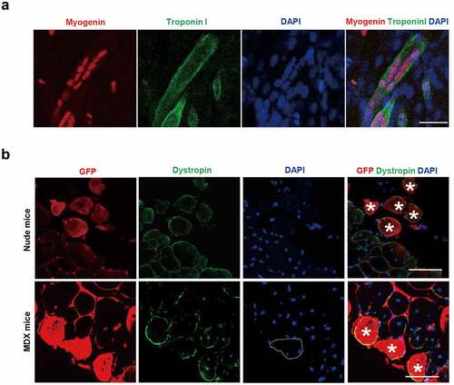 Figure 4. Myogenic differentiation potential of iMLC in vitro and in vivo. (a) Myogenic differentiation test in vitro. In differentiation media, iMLCs represented terminal stage of myogenic differentiation after incubated in myogenic differentiation media. The iMLCs are fused together and form multinucleated myotubes. Scale bar = 100 µm. (b) Myogenic differentiation test in vivo. The GFP-labeled iMLCs are transplanted into notexin-injured tibialis anterior muscles of nude (upper panel) or mdx mice (lower panel). The asterisks indicate codetection of GFP and dystrophin. Scale bars = 150 µm.