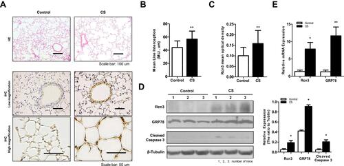 Figure 2 Rcn3 expression in lung tissues from CS-induced mouse model of emphysema. A total of 16 C57BL/6 mice (6 weeks old) were exposed to cigarette smoke for 6 months as emphysema mice (CS group) and 16 C57BL/6 mice were exposed to air for 6 months as Control mice (Control group). (A) Photomicrography of pulmonary parenchyma stained with H&E (upper panels). Bar size: 100 μm; IHC assays of Rcn3 (low and high magnifications, lower panels). Bar size: 50 μm; (B) Morphometric analysis of the MLI ((44.00 ± 2.528 μm vs.56.81 ± 3.053 μm, n = 16 per group, p<0.01); (C) The mean optical density of Rcn3 expression was measured in the lung tissues according to the Rcn3 IHC assays (3 random views, 100× amplification for one subject, n = 16 per group, p<0.01); (D) Representative WB for protein levels of Rcn3, GRP78 and Cleaved caspase-3 in lungs and the ratios to β-Tubulin presented by bar graph, n = 8 per group; (E) Expressions of Rcn3 and GRP78 mRNA were determined with Qualitative PCR analysis, n = 9–10 per group. Data presented as mean ± SEM; *p<0.05, **p<0.01 versus the Control group.