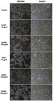 Figure 2 Cell morphology following treatment with the engineered nanoparticles. Human embryonic kidney (HEK293; left) and keratinocyte (HaCaT; right) cells were treated with gold nanoparticles (AuNPs), silicon nanoparticles (SiNPs), and chitosan nanoparticles (CSNPs) for 72 hrs and then visualized under a phase-contrast microscope (magnification, 200×). Cells in the control group were treated with engineered nanoparticle-free medium.