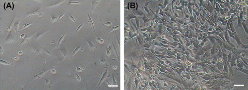 Figure 1. Morphology of rat cardiac stem cell and vascular endothelial cells. (A) Rat primary c-kit+ cardiac stem cells after purification through FCM. (B) Vascular endothelial differentiation of rat c-kit+ cardiac stem cells, cells converted from fusiform and triangular to roundness in shapes after day 6.