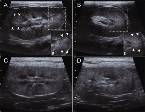 Figure 1. The presence (A, B) and absence (C, D) of renal CABA in median longitudinal (A, C) and transverse (B, D) plane of the feline kidney. Magnified images of the presence of renal CABA from the rectangular dotted region of (A) and (B) are shown in (a) and (b), respectively. The arrowheads indicate focal hyperechogenic trapezoid regions with indistinct or faded margins at 3 and 9 o’clock of the renal cortex compared with the rest of the cortex.