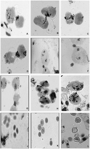 Figure 1 (A) Chromatin transfer with one PMC at diakinesis; (B) migration of chromatin through cytoplasmic bridge; (C) empty cell with a remnant after migration of chromosomes; (D) complete migration of chromatin with one PMC showing bidirectional movement of chromatin; (E) cytoplasmic connection between cells with a single chromatin ball at junction, one PMC showing secondary association of chromosomes; (F) cytomixis between adjacent cells with one PMC at metaphase-II; (G) migration of chromatin material between cells in chain with one cell showing affinity to form connection; (H) simultaneous and multiple cytoplasmic connections in group of PMCs; (I) chromatin bridge between hyperploid PMCs; (J) tetrad and triad; (K) smaller and larger pollen grains (unreduced pollen); (L) fertile (stained), semi sterile (half stained) and sterile pollen grains (lightly stained).