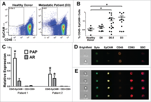 Figure 2. Circulating tumor cells can be detected by flow cytometry in the peripheral blood of patients with advanced prostate cancer. (A–B) PBMC collected from patients with varying stages of disease (non-castrate, non-metastatic, PSA-recurrent (D0); castrate-resistant, non-metastatic, PSA-recurrent (D0.5); castrate-resistant, metastatic (D3)); or healthy donor controls were assessed for the frequency of CD45-EpCAM+ cells (CTCs) by multi-parameter flow cytometry. Shown are representative dot plots (A) or group averages (B) for the frequency of Live/CD45−/EpCAM+ cells as the percentage of total live events. (C) CTCs or CD3+/CD8+ T cells (negative control) were isolated via FACS and their expression of two prostate-specific transcripts was analyzed using quantitative PCR. Graphed is the relative mRNA expression of prostatic acid phosphatase (PAP) and the androgen receptor (AR) normalized to the housekeeping gene P0. (D, E) The morphology of the CTC population was evaluated using high-throughput single-cell fluorescence imaging. Shown are representative images of nucleated CD45−/EpCAM+/CD63+ cells (E) or CD45+ cells as control (D). All panels: *p ≤ 0.05 using a Mann–Whitney test.