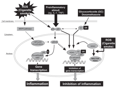 Figure 2 Model showing the possible mechanism of histone acetylation by oxidative stress and its repression by corticosteroids (GCs), leading to inhibition of gene transcription. Mitogen-activating protein kinase (MAPK) signaling pathways may be activated by oxidative stress, leading to histone acetylation. Direct interaction between co-activators (HAT), histone deacetylase (HDAC), and the glucocorticoid receptor (GR) may result in repression of the expression of proinflammatory genes. HDAC forms a bridge with HAT to inhibit gene transcription. However, when the HDAC is inhibited by oxidants or the NF-κ B subunit p65 is acetylated, steroids may not be able to recruit HDACs into the transcriptional complex to inhibit proinflammatory gene expression.