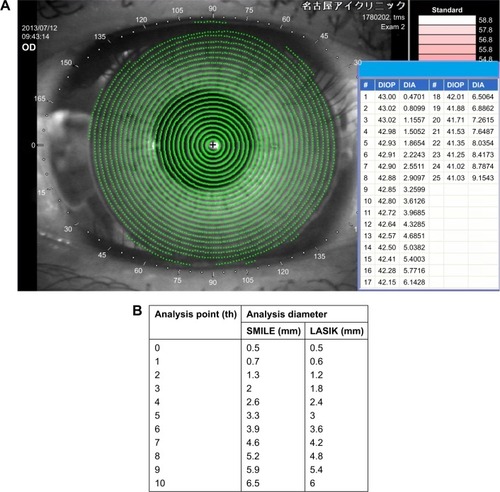 Figure 1 Representative image of corneal topography and analysis points in SMILE and LASIK groups.