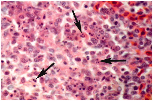 Figure 5. Spleen of broiler chick administered chlorpyrifos (20 mg/kg BW) at post-treatment Day 15. Representative photomicrograph shows congestion and fragmentation of nuclei (apoptotic changes) (arrows). H&E stain. Magnification = 400×.