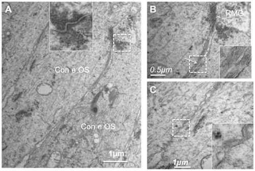 Figure 10 Ultrathin sections of the OLM in the fovea of a human retina. (A) Junctions between Müller glia and cones showing typical desmosome structure (inset) with dense actin filaments. (B) higher magnification of the glial cell extension between cones. (C) Junctions between cones.