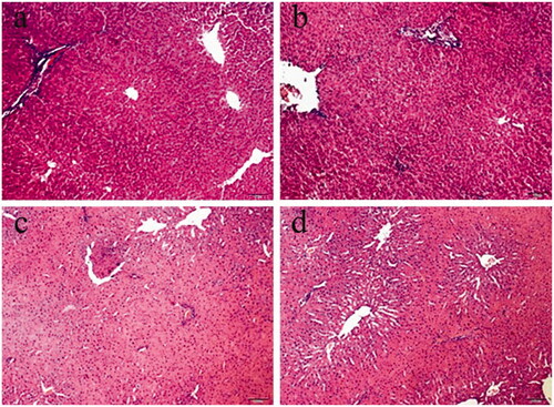 Figure 2. Liver damage was analyzed by liver histology (representative H&E staining; original magnifications, 100× magnification). (a) Sham, (b) l-NAT, (c) I/R, (d) I/R + l-NAT.