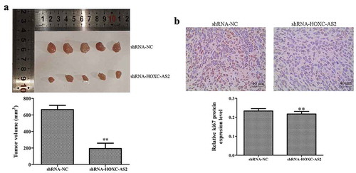 Figure 5. HOXC-AS2 silencing suppresses NSCLC development in vivo. (a) Compared with the shRNA-NC group, shRNA-HOXC-AS2 inhibited the tumor volume (bar = 10 mm). (b) The expression of Ki-67 was measured using immunohistochemistry (IHC) assay. *P < 0.05 (vs shRNA-NC), **P < 0.01 (vs shRNA-NC). Data were represented as means ± standard deviation (SD). Each experiment was performed in triplicate