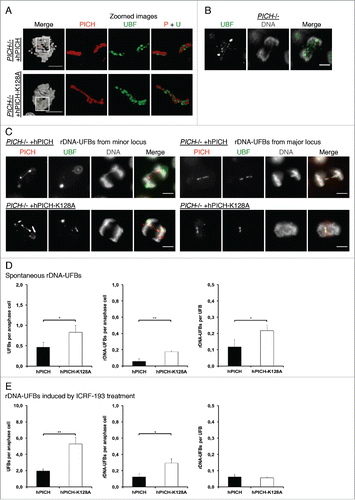 Figure 3. The rDNA marks a novel class of UFBs. (A,C-E) PICH−/− cells ectopically expressing either hPICH or hPICH-K128A were arrested in prometaphase using nocodazole then released into drug-free medium or medium containing 0.25 μM ICRF-193 for 40 min, as indicated. (A-C) PICH (red) and UBF (green) were detected using specific antibodies and the DNA (grayscale) was stained with DAPI. Scale bars, 5 μm. In panel A, cells were imaged using structured illumination microscopy and the images were 3D rendered. White boxes denote zoomed images. (B) An example of a DAPI-negative rDNA-UFB in an untreated PICH−/− cell. (C) Representative examples of rDNA-UFBs arising from either the major or the minor rDNA locus in PICH deficient cells expressing either wild-type hPICH or hPICH-K128A (as indicated). (D/E) Quantification of total UFBs per anaphase (left), of rDNA-UFBs/anaphase (middle), and of rDNA-UFBs/UFB (right) in PICH deficient cells expressing either wild-type hPICH or hPICH-K128A (as indicated). Each data point is an average of at least 3 independent experiments. Significance levels were calculated using a Students t-test for parametric observations and are indicated as *P < 0.05, **P < 0.01 and ***P < 0.001.