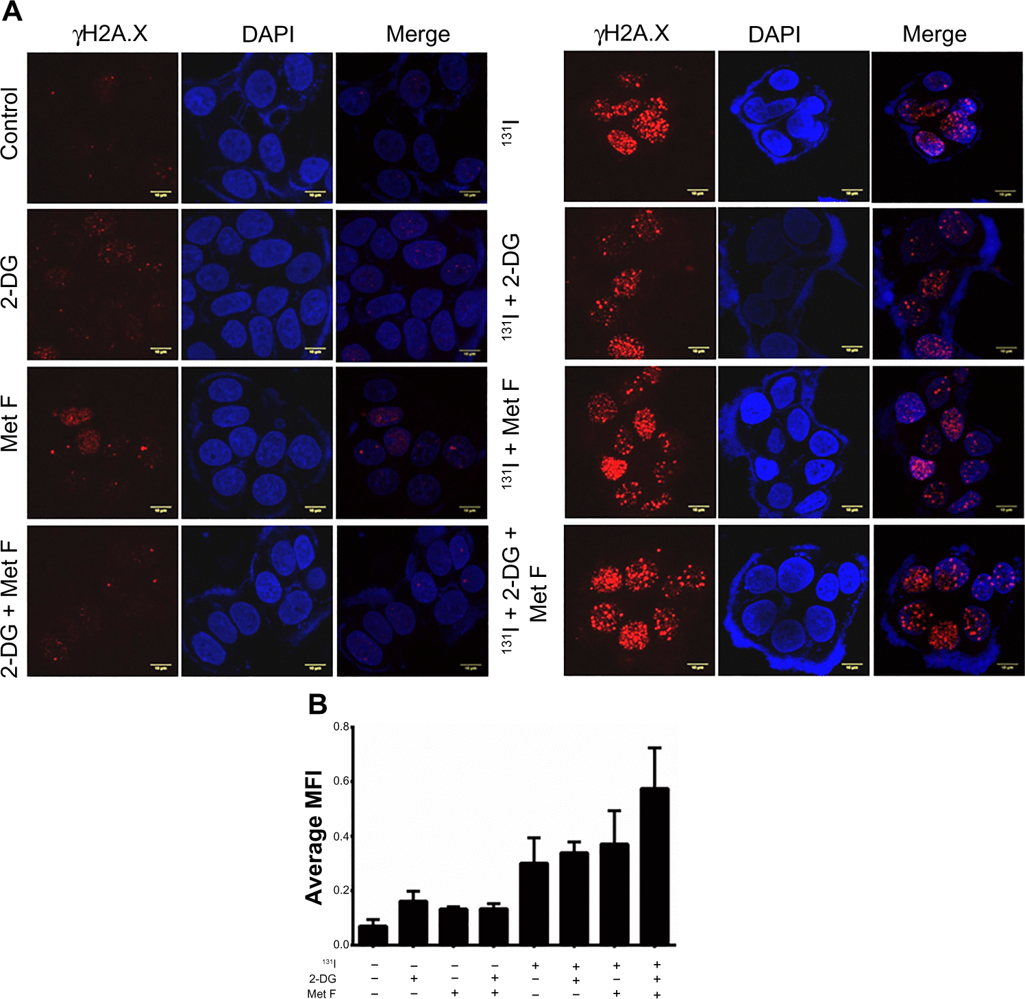 Figure S4 (A) Foci assay images from Figure 4 (MCF-7 NIS cells treated with 131I and its combination with radio sensitizers) showing foci staining with dylight 633 secondary antibody in red channel, nucleus stained with DAPI in blue channel, and merged image showing colocalization of foci with nucleus. Scale bars represent 10 μm. (B) Quantification of foci from the IF images. In each sample, 50 cells were quantified for intensity of staining from various fields of the cover slip.