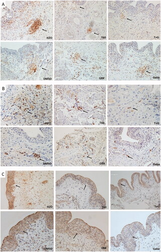 Figure 4. Immunohistochemical analysis of the bladder tissues. Effects of Cernitin™ on the expression of (A) CD45, (B) PGD2 and (C) SP. T + G = T60 + GBX. Immunostaining was performed in the five animals mentioned in Table 2. intensity was determined by color intensity as follows; strongly stained as score 3, moderately stained as score 2 and weakly stained as score 1, no staining as score 0.