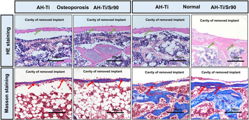 Figure 10 Histological analysis of new bone formation around the implants.