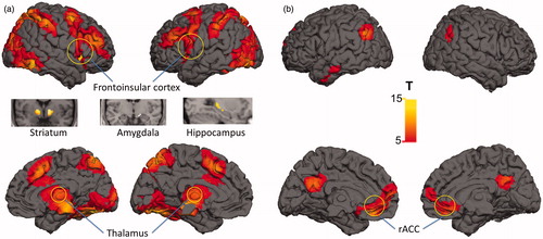 Figure 4. Main effect of social stress induction: activation (a) and deactivation (b). The functional maps are thresholded at a significance threshold of p < 0.05 FWE corrected for multiple comparisons across the whole brain. Neural response included activations in ventral striatum, thalamus, frontoinsular cortex, hippocampus and amygdala and deactivations in rACC (all p < 0.05, whole-brain FWE corrected); FWE = family-wise error corrected for multiple comparisons.