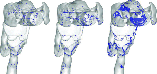 FIG. 5 Oral airway deposition patterns for 2.5, 10, and 30-μm particles with respective deposition efficiencies of 3.9%, 9.5%, and 75.0% (left, middle, right).