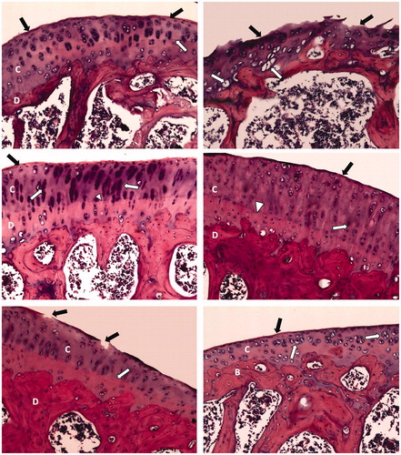 Figure 2. Photomicrographs of articular cartilages of different sections (H&E; 200×). Normal control rat section (top left) shows a smooth continuous articular surface (black arrow) and a regular tide mark (white arrow) separating the articular cartilage (C) from the underlying subchondral bone (D). Arthritis control rat section (top right) shows disrupted articular surface (black arrow) with chondrocytes showing degeneration with pyknotic nuclei (white arrow). Dexamethasone-treated arthritic rat section (middle left) shows smooth articular surface (black arrow) and thickened articular cartilage (C) and subchondral bone (D). The chondrocytes (white arrow) show hypercellularity and cloning, while regular tide mark can be seen (arrowhead). Methotrexate-treated arthritic rat section (middle right) shows smooth articular surface (black arrow) with thickened articular cartilage (C) and subchondral bone (D). The chondrocytes (white arrow) show hypercellularity and cloning, and regular tide mark can be seen (arrowhead). Fenofibrate-treated arthritic rat section (bottom left) shows a narrow area of disrupted articular surface (black arrow). Thickened articular cartilage (C) and subchondral bone (D) can be observed. Regular tide mark can also be observed (white arrow). Resveratrol-treated arthritic rat section (bottom right) shows a smooth articular surface (black arrow). The articular cartilage (C) shows hypercellularity and aggregation of chondrocytes (white arrow). Subchondral bone (B) can be observed.