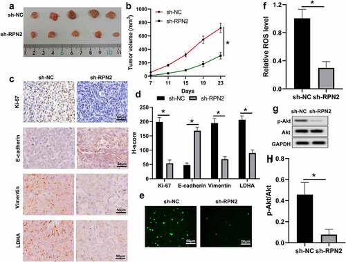 Figure 6. Knockdown of RPN2 suppressed the tumorigenicity of LSCC cells in a xenograft tumor model. (a) Mice were sacrificed on day 23 and tumor images were exhibited. (b) Tumor volume of each mouse was calculated every 4 days from 7 days after implantation. (c) IHC assay for the levels of Ki-67, E-cadherin, Vimentin, and LDHA in mouse tumor tissues, and (d) H-score was used to measure the staining intensity. (e and f) ROS levels in mouse tumor samples were analyzed. (g and h) p-Akt/Akt level was downregulated by sh-RPN2 in tumors. *P < 0.05.