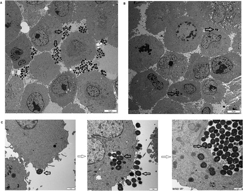 Figure 4. Transmission electron microscopy analysis of the ability of Moraxella catarrhalis to adhere and invade A549 cells. The distribution of M. catarrhalis 35-OR (resistant isolate) (A) and M. catarrhalis 73-OR (susceptible isolate) (B) outside and inside A549 cells at 4 h post-infection (magnification: ×3000). (C) Lamellipodia enclosing M. catarrhalis 73-OR (susceptible isolate) at 4 h post-infection and different phases of macropinocytotic ingestion (magnification: ×15000). M. catarrhalis isolates are shown using arrows. Scale bars: 5 (A and B) or 1 µm (C).