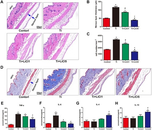 Figure 8 Images of hematoxylin eosin and Masson trichrome staining on the air pouch tissues at day 4.Notes: (A) hematoxylin eosin stained images showing a whole structure and layers of the air-pouch tissues. (B) Thickness of fibrous layer. (C) Numbers of infiltration cells. (D) Masson’s trichrome stained images obviously displaying the fibrous tissues and the infiltration cells. Cytokines in the air-pouch exudates were evaluated by ELISA: (E) TNF-α; (F) IL-6; (G) IL-4; and (H) IL-10. scale bar: 200 μm. (*# and + represent P<0.05 when compared with Control, Ti, and Ti+LiCl1 respectively).Abbreviations: ELISA, enzyme-linked immunosorbent assay; TNF-α, tumor necrosis factor alpha; IL, interleukin.