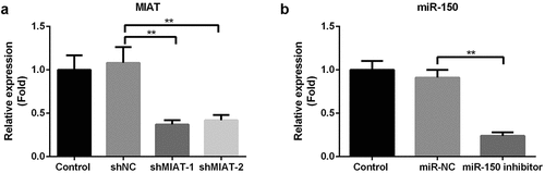 Figure 4. Transfection of shMIAT and miR-150-5p inhibitor in BMSCs. The level of MIAT was significantly inhibited by the transfection of shMIAT-1 and shMIAT-2 in BMSCs (a). miR-150-5p inhibitor significantly decreased the level of miR-150-5p in BMSCs (b). **p < 0.01.