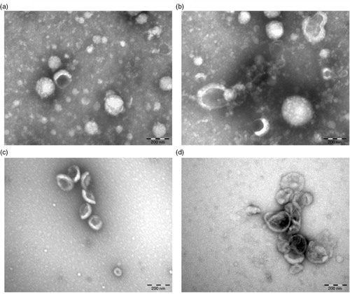 Fig. 5.  Effect of centrifugation on plasma EVs. Plasma was centrifuged at 18,890×g for 2 hours and the pellet was resuspended and analysed using TEM (a, b). To reduce background due to plasma proteins, the same plasma was diluted 8-fold prior to centrifugation using the same condition (c, d).