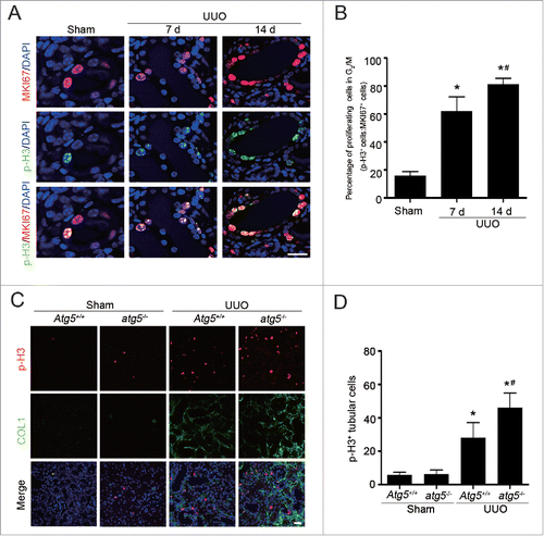 Figure 5. Tubular cell G2/M arrest is increased in UUO-induced fibrotic kidney. (A) Dual immunofluorescence of MKI67 (red) and p-H3 (green) in sham-operated and UUO kidneys on d 7 and 14 in C57BL/6 mice. DAPI (blue) was used for nuclear staining. Scale bar: 20 μm. (B) The percentage of MKI67+ p-H3+ cells among total MKI67+ tubular cells in different groups. Data represented as mean ± SEM (n = 6); *, P < 0.05 vs. sham. #, P < 0.05 vs. UUO 7 d. (C) Representative immunofluorescence staining of p-H3 (red), COL1 (green), and DAPI (blue) on kidney sections of Atg5-deficient mice from different groups. Scale bar: 20 μm. (D) Quantification of tubular cells with p-H3 positive. Data represented as mean ± SEM (n = 6); *, P < 0.05 vs. sham; #, P < 0.01 vs. obstructed kidney of Atg5+/+ mice.