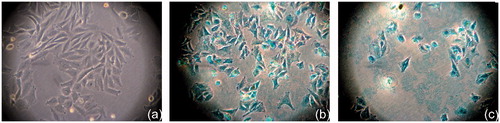 Figure 2. Optical microscopy imaging 17 × of control SaOS-2 sample (a). Prussian Blue stained SaOS-2 after 48 h incubation with MnFe2O4/Fe3O4 (Mn + Fe) (b) and Prussian Blue stained SaOS-2 after 48 h incubation with CoFe2O4/Fe3O4 (Co + Fe) (c) The cells’ colour became blue or partially blue (b and c), indicating the MNPs internalisation by the cancer cells.