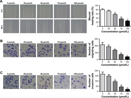 Figure 2 Mifepristone inhibited HHUA cells migration and invasion in a dose-dependent manner.