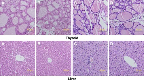 Figure 7 Histologic sections of thyroid, liver, and lung.Notes: (A) Male rats of nano-Cu/LDPE group. (B) Male rats of control group. (C) Female rats of nano-Cu/LDPE group. (D) Female rats of control group. No abnormalities were detected in any groups.Abbreviation: Cu/LDPE, copper/low-density polyethylene nanocomposite.