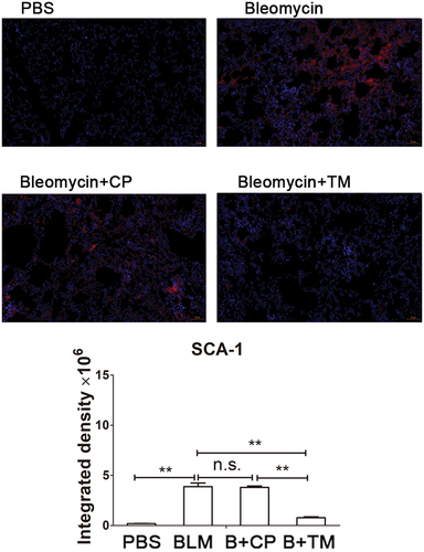 Figure 3. Immunization with the Tocilizumab mimotopes reduced the proportion of lung fibroblasts the tissue sections were incubated with anti-sca-1 antibody and followed by Alexa Fluor 594-conjugated secondary antibody. Representative images were captured with a microscope (×200 magnification, presented bar: 50 μm). Each image of immunofluorescence was acquired at the same adjustment parameters. Red (SCA-1): black (15.0) gamma (1.0) white (70.0). The results showed that immunization with the Tocilizumab mimotopes could reduce the proportion of fibroblasts in BLM-induced model. (mean ± SEM; **p < .005; n.s. non-significant; Representative image, n = 6 mice per group).