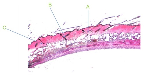 Figure 1 Photographic example of the histological scoring method. The histological parameters of epidermal regeneration of mouse skin scored were (A) the presence or absence of epithelial covering, (B) presence of conical epithelial covering, and (C) degree of epithelial cell layers (monolayer or multilayer).