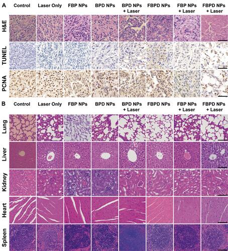 Figure 10 (A) H&E, TUNEL and PCNA staining on tumor sections from SKOV-3 tumor-bearing mice after various treatments. (B) H&E staining of the major organs (heart, liver, spleen, lung, and kidney) of SKOV-3 tumor-bearing mice after different treatments. The scale bars are 50 µm.