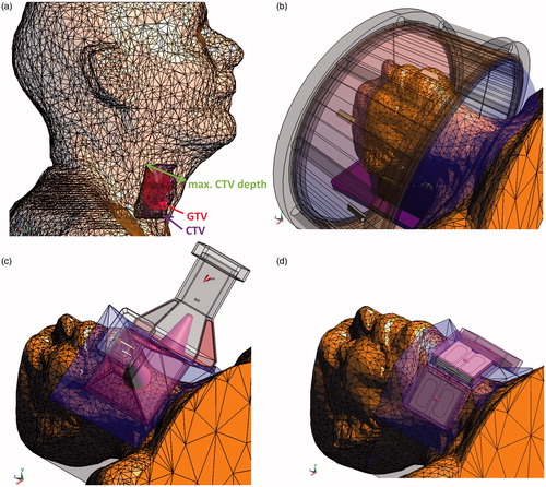 Figure 1. (a) Patient 3D model in SEMCAD X with highlighted CTV and GTV (homogeneous transparent patient model was used for better visualisation of CTV and GTV). Example of treatment planning setups for all studied applicators, (b) HYPERcollar, (c) Lucite cone applicator and (d) current sheet applicator.