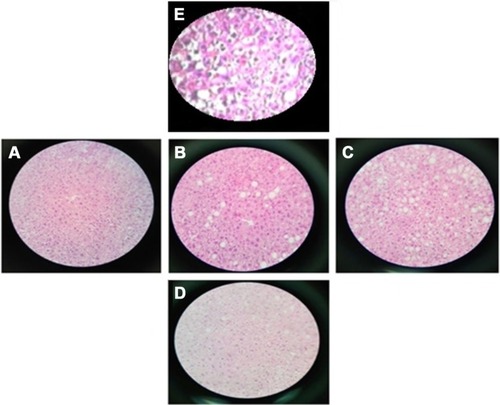 Figure 3 Histopathological evaluation of liver section slides: (A) 4a group; (B) 6a group; (C) 6b group; (D) standard drug group; and (E) hyperlipidemic control.