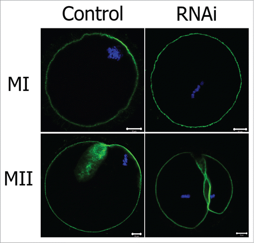 Figure 6. Effect of TGN38 depletion on actin cap formation in mouse oocytes. Oocytes were co-stained with Phalloidin-FITC (green) and Hoechst 33342 (Blue). Bars, 10 μm.