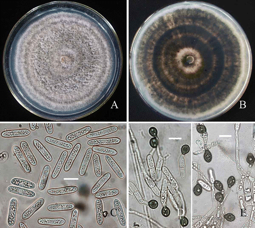 Figure 3. Morphological characteristics of C. horii (from Diospyros kaki cv. Wuhesh). A-C, on PDA. A, view of colony. B, reverse view of colony. C, conidia. D, appressoria formed on polystyrene Petri dish. E, appressoria formed on coverslips. Bar = 10 μm.