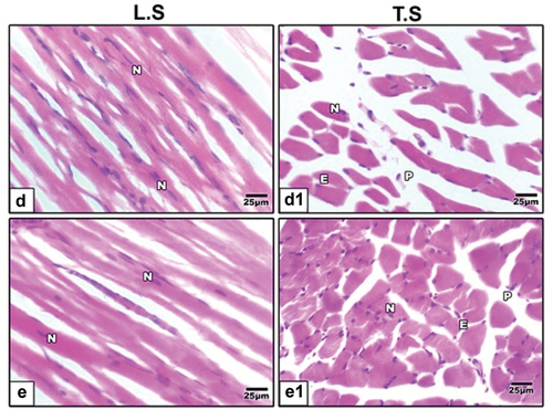 Figure 3. Photomicrographs of histological sections of tibialis muscle stained by hematoxylin and eosin (H&E) in 21-day-old rat. High fat diet plus germinating (d & d1) barley and (e & e1) fenugreek grains supplementation showed improvement in muscle fibers.