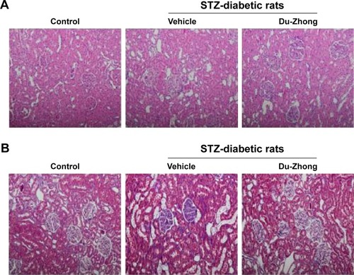 Figure 1 Histological changes influenced by Du-Zhong.